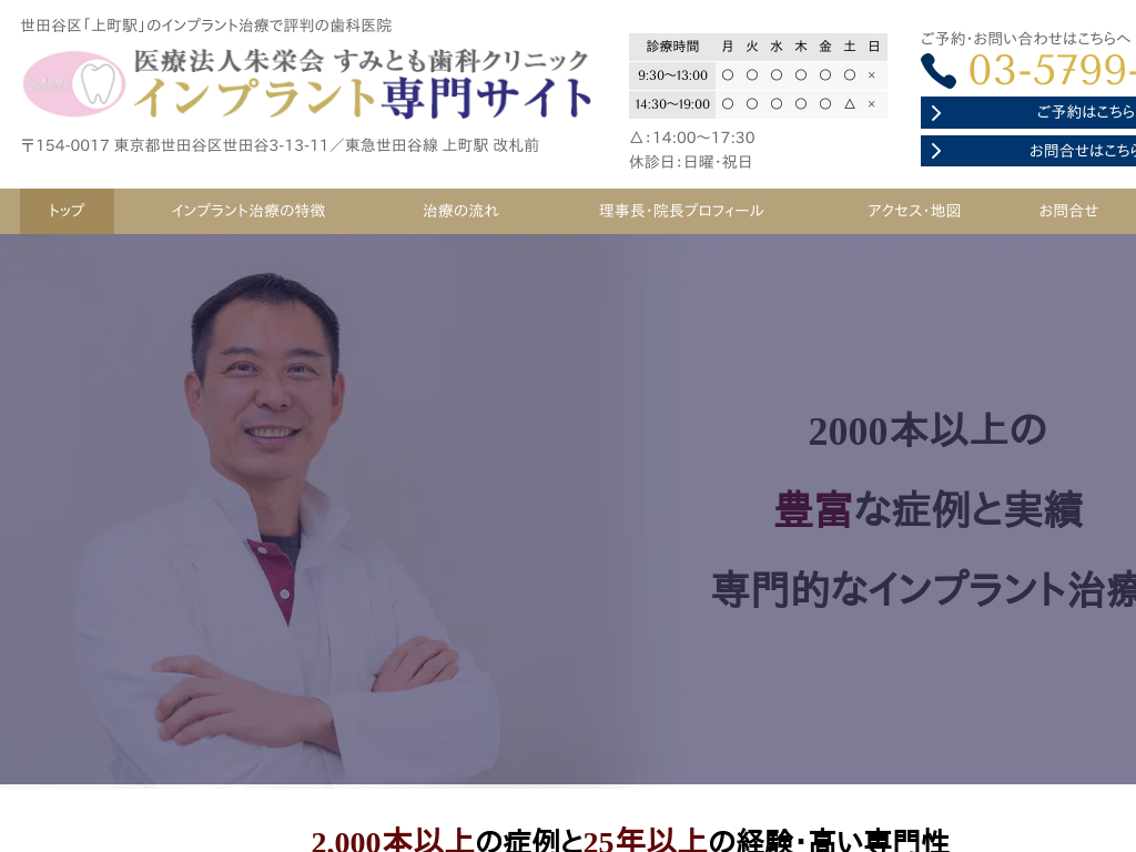 東京都世田谷区の　すみとも歯科クリニック インプラント専門サイト