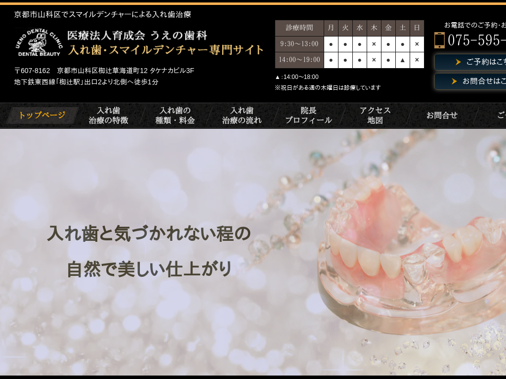 京都府京都市の　うえの歯科・スマイルデンチャー（入れ歯）専門サイト